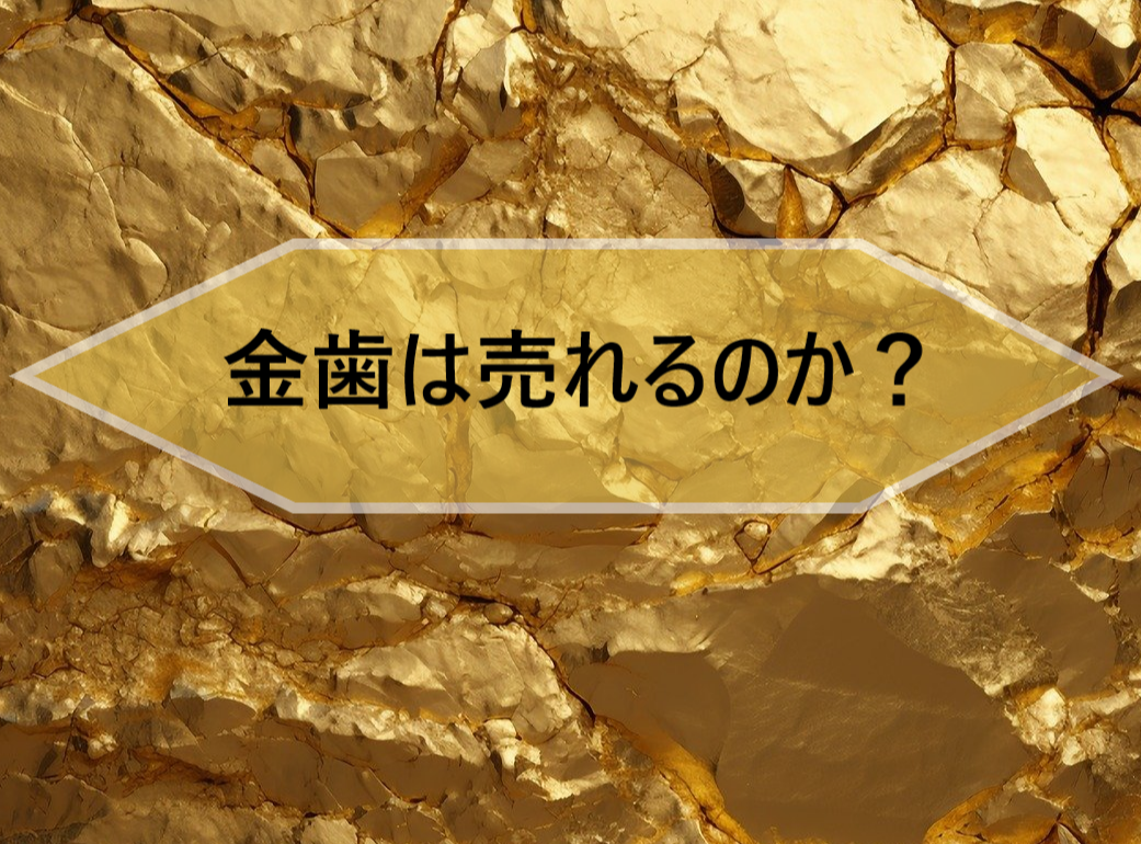 金歯は売れるのか？